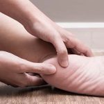 ACG-Female foot heel pain, plantar fasciitis disorder