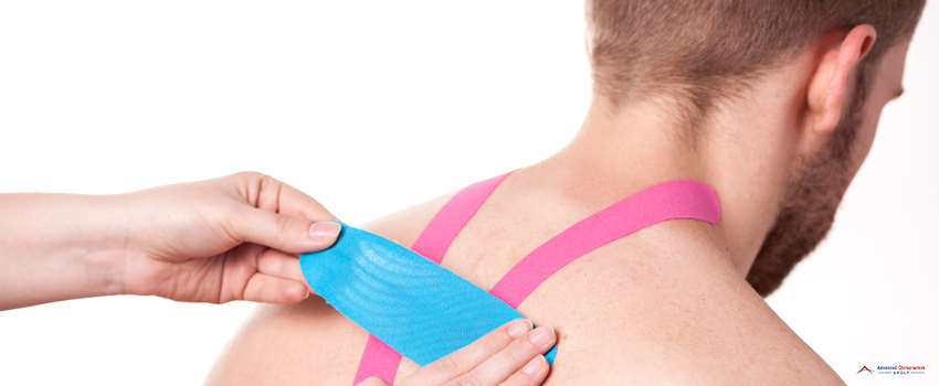 ACG-Kinesio taping on upper back