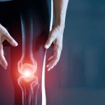 ACG-Woman suffering from pain in knee, Injury from workout and osteoarthritis