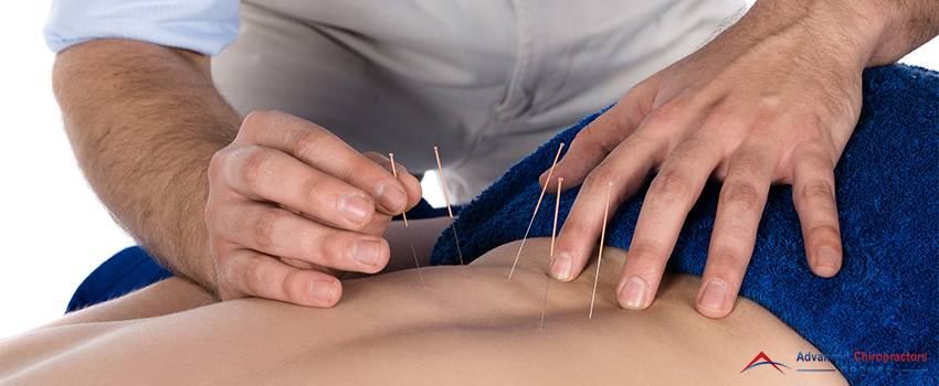 Acupuncture and Chiropractic Care - Is It a Good Combination