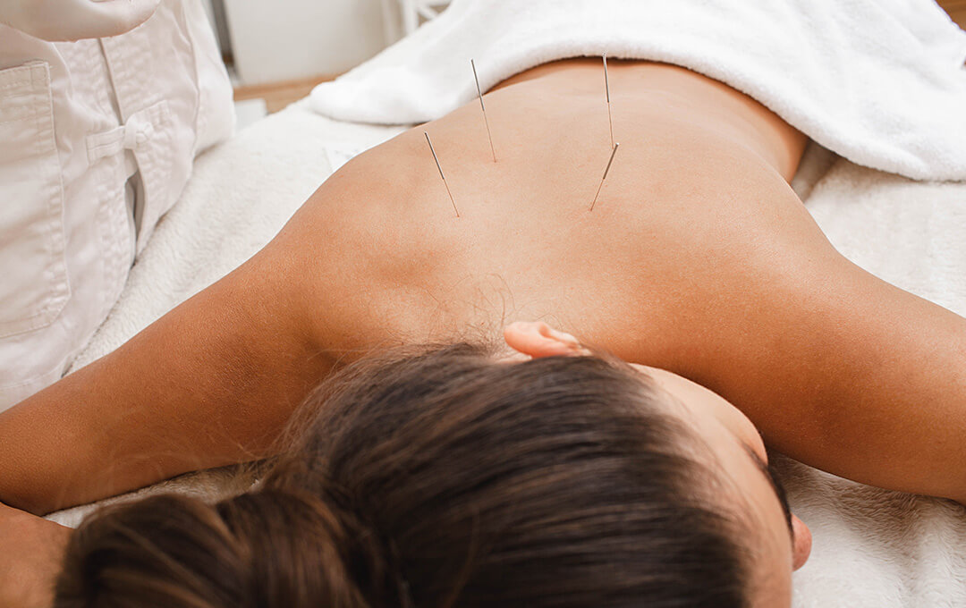 ACG What is Medical Acupuncture